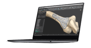 SolidWorks Biomedical Innovation